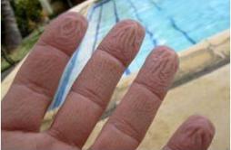 为什么手指泡在水里会起皱？