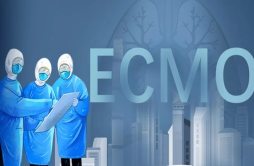 ECMO是什么意思_ecmo英语怎么读_ecmo为什么这么贵？